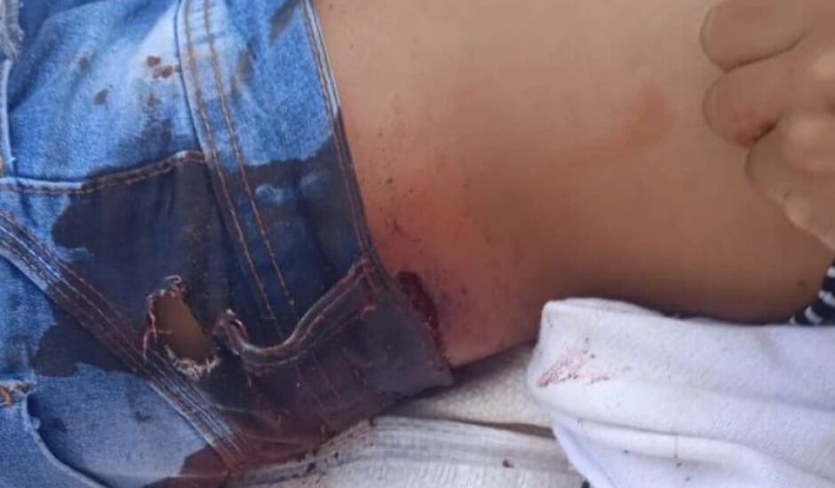 Imagem de indígena ferido em ação policial foi divulgada por entidades Guarani Kaiowá