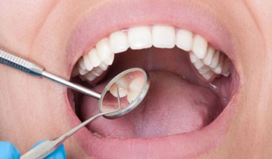 Primeiro diagnóstico é feito pelo dentista e, após confirmação, é feito encaminhamento ao médico.