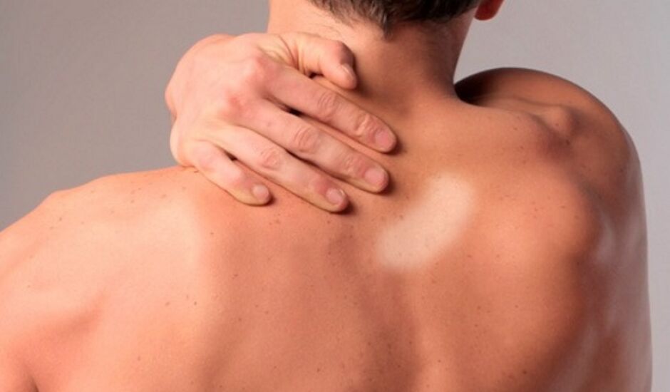 Manchas ou vermelhidão na pele são os principais sinais de hanseníase