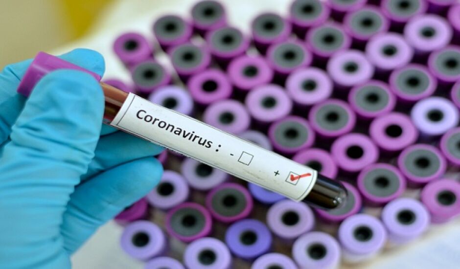 Maioria dos casos foram confirmados em Campo Grande; todos tem relação com algum outro paciente contaminado com o coronavírus