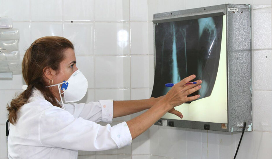 No Brasil, em 2019, foram registrados 73.864 mil casos novos da doença