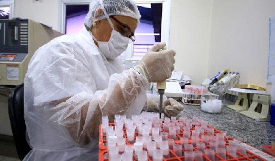 Exames de Covid-19 são realizados pelo Laboratório Central de Mato Grosso do Sul (Lacen)