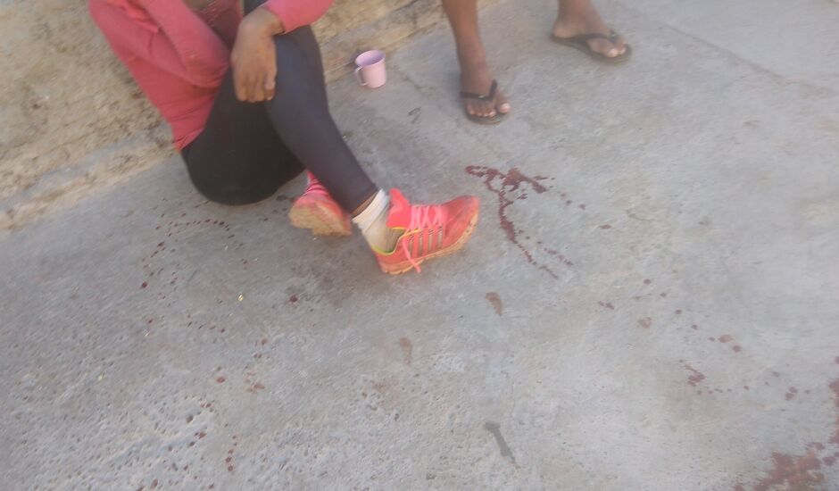 Homem acerta pedrada na cabeça de sobrinha para roubar R$20 da vítima