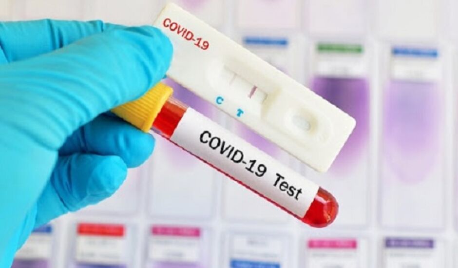 Três óbitos causados pela covid-19 foram registrados até o momento