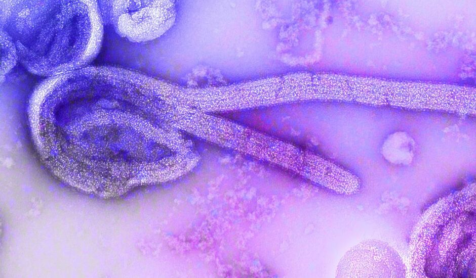 O vírus Chapare causa sintomas muito semelhantes ao Ebola
